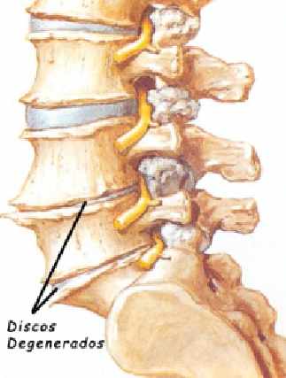 Foto 7 - Quiropraxia na coluna vertebral